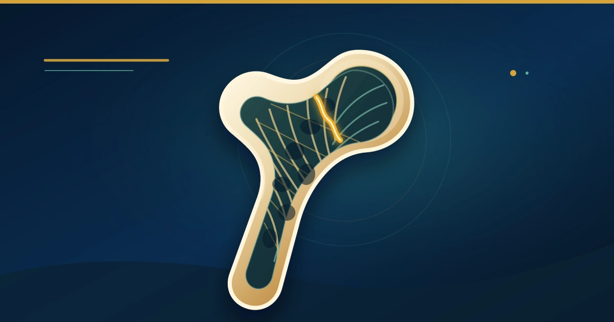 Broken a Bone From a Simple Fall? It May Be a Fragility Fracture