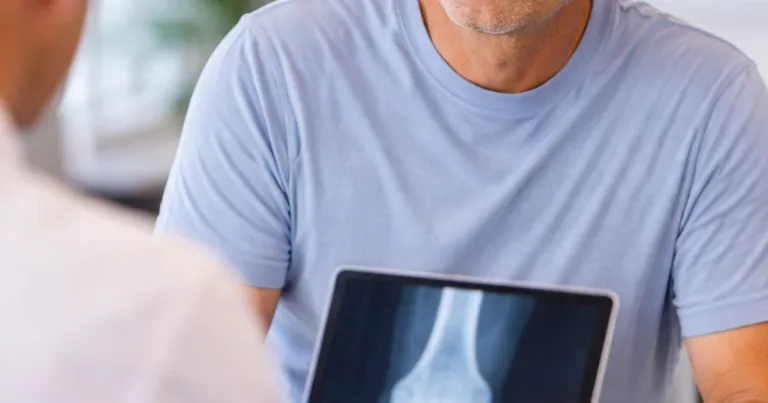Knee Replacement Recovery Week by Week: What Patients Can Expect