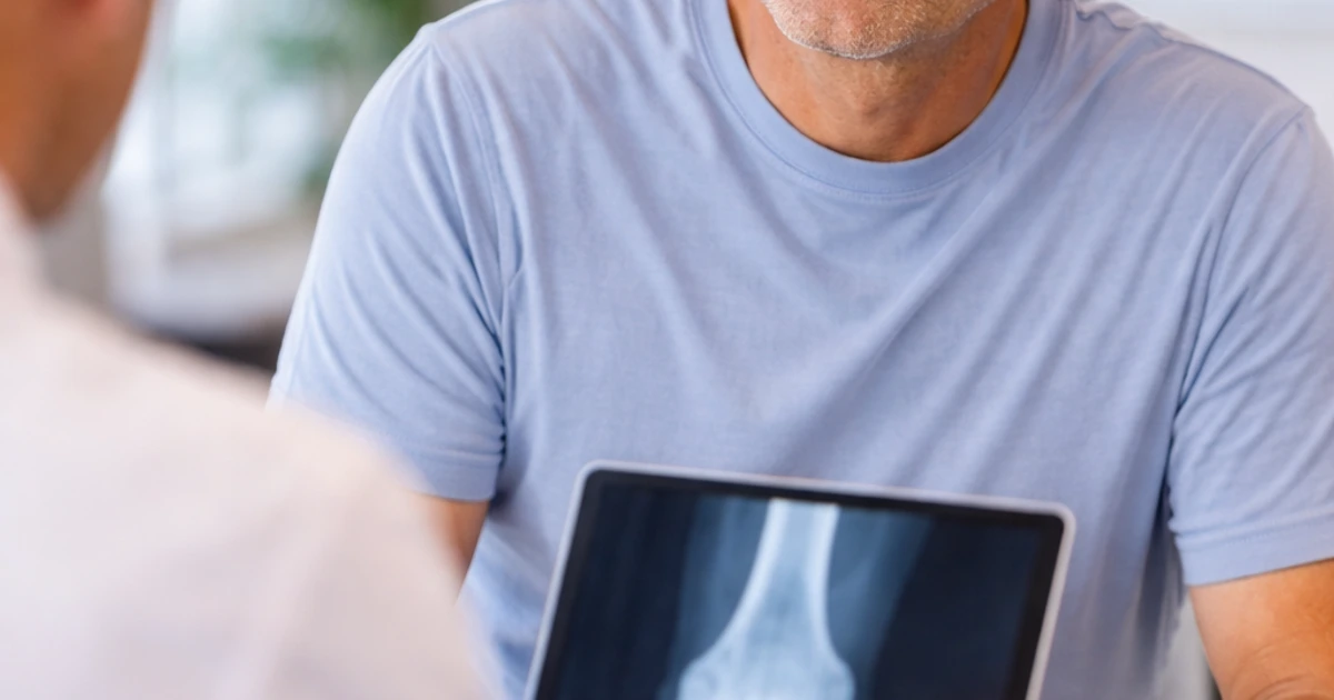 Knee Replacement Recovery Week by Week: What Patients Can Expect