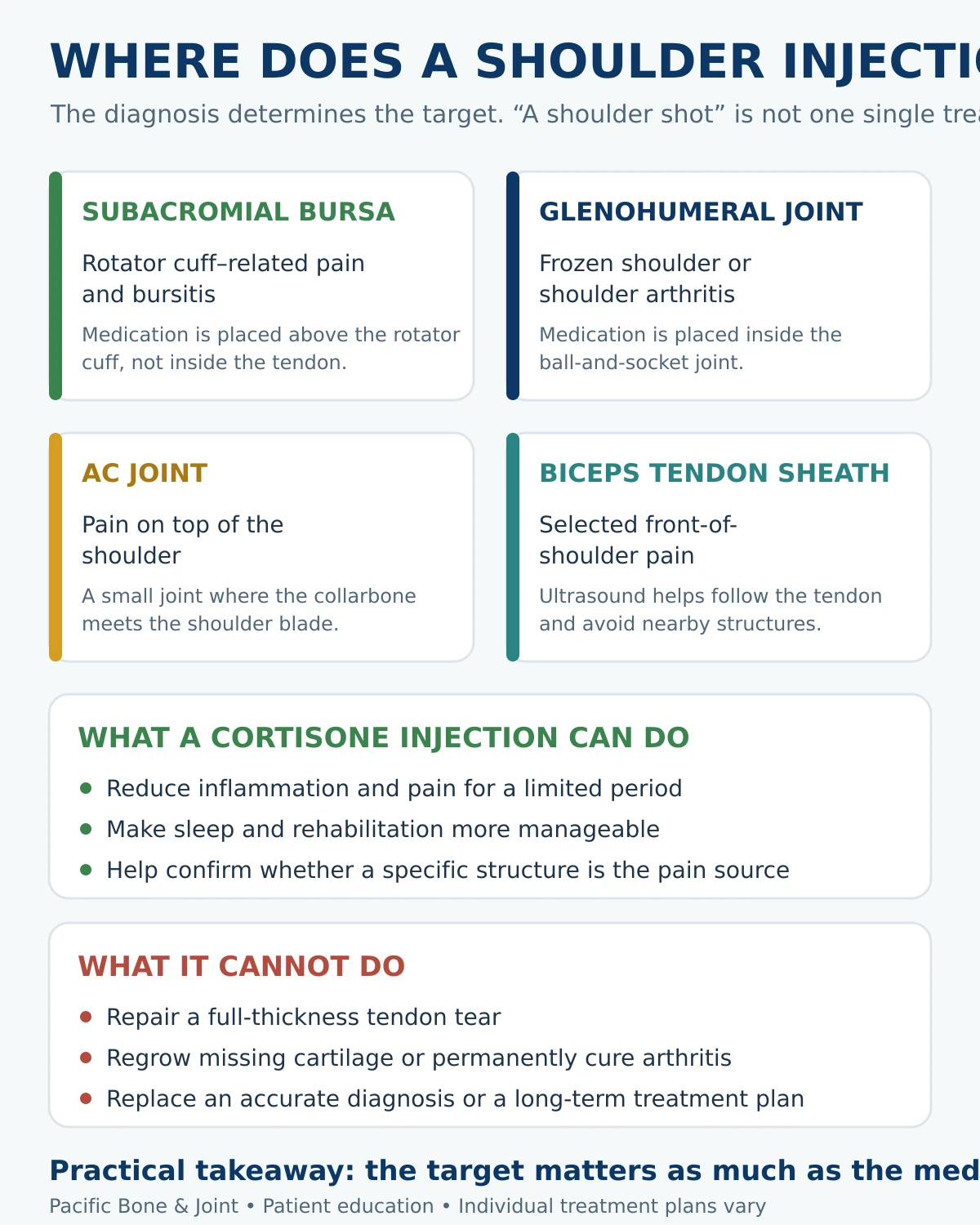 Patient-friendly guide showing the four common shoulder injection targets, what cortisone can do, and what it cannot do